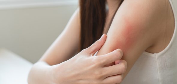 How do you tell the difference between a spider bite and a bed bug bite?